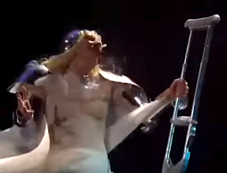 Lady Gaga on Crutches